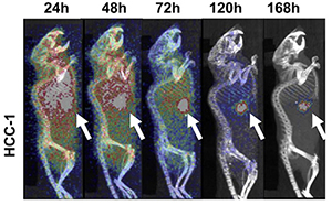 PET image HCC 1 xenograft new